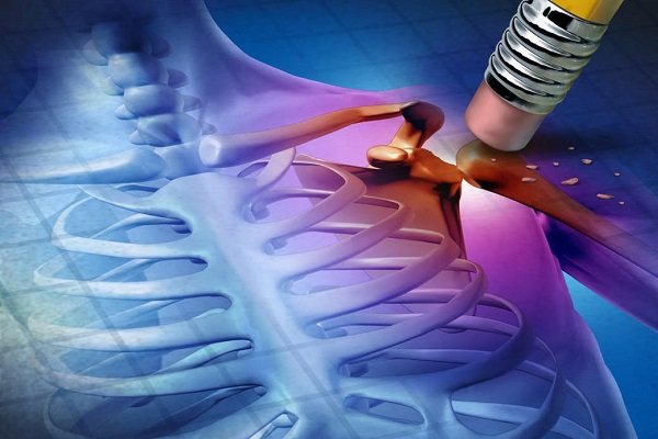 کنترل درد بیماران بدون استفاده از داروهای مخدر