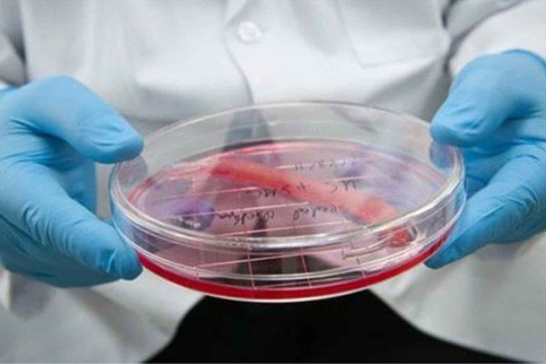 یافتن راهی برای سلول درمانی بدون پیوند سلول های بنیادی