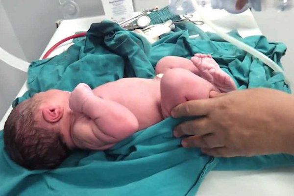 ارزآوری ایران از درمان ناباروری/ افزایش سرطان دهانه رحم