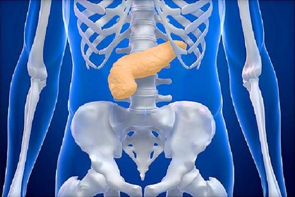 دیابت اولین علامت هشدار دهنده سرطان لوزالمعده