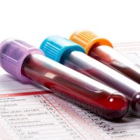 قبل از آزمایش بخوانید!