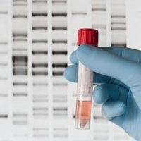 غربالگری را جدی بگیرید